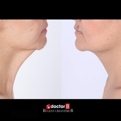 Before after photos of our patients 0
